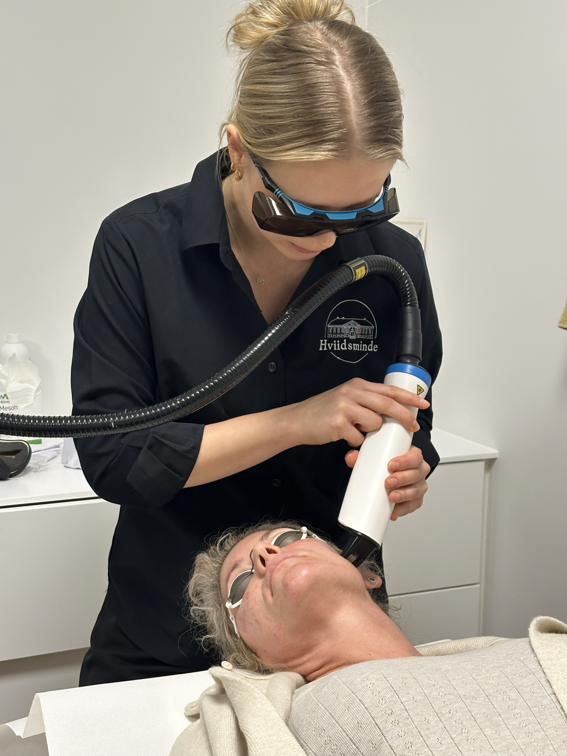frax laser, dualfrax, ipl, laser, hårfjernelse med laser 